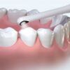 Dental Endoscope_0011_img_9_Youpin_TIMESISO_Intelligent_Visual_Oral_.jpg